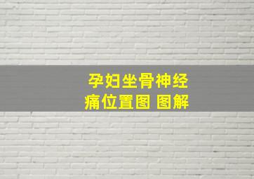 孕妇坐骨神经痛位置图 图解